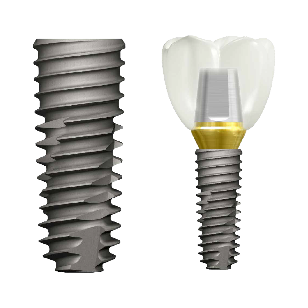 implant